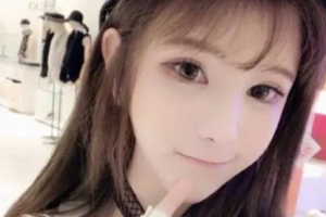 南京市兒童醫(yī)院燒傷整形外科沈衛(wèi)民整形價(jià)格表附面部吸脂案例展示