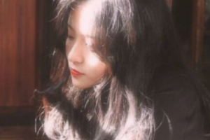 南京華美美容醫(yī)院孫萬(wàn)秀整形價(jià)格表附顴骨顴弓整形術(shù)案例展示