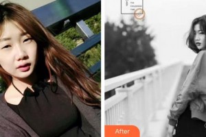 上海市紅十字眼耳鼻喉醫(yī)院整形外科胡文明整形價格表附眼部綜合案例展示