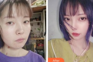 上?，旣愥t(yī)院整形美容中心李云天主診醫(yī)師整形價格表附皮膚清潔補(bǔ)水嫩膚案例展示