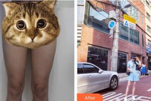 上海新星醫(yī)療美容整形外科吳坤南整形價格表附全身吸脂+面吸案例展示