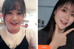 上海百達(dá)麗醫(yī)療美容醫(yī)院林曉松整形價(jià)格表附金屬托槽矯正案例展示