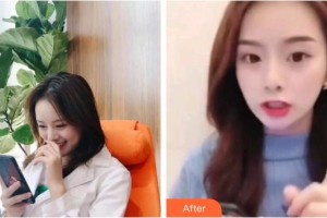 上海文峰醫(yī)療美容門診部寧守國整形價格表附超聲波潔牙案例展示