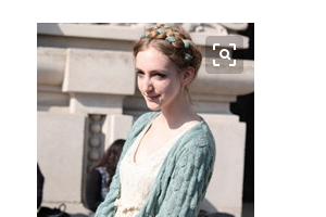 南京斑教授醫(yī)療美容診所芮雪萍整形價(jià)格表附切開(kāi)雙眼皮案例展示