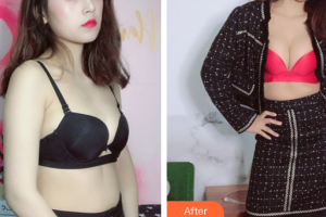 廣州韓妃醫(yī)學(xué)美容醫(yī)院黃招標(biāo)整形價格表附濃縮豐胸案例展示