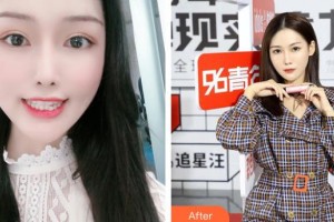 上海百達(dá)麗醫(yī)療美容醫(yī)院董曉瑾整形價(jià)格表附隱形矯正案例展示