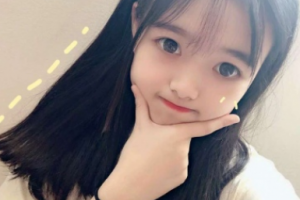 南京美好尉來(lái)整形美容診所孫露整形價(jià)格表附面部吸脂案例展示