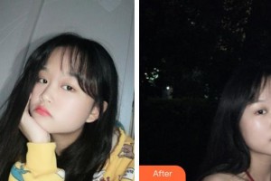 武警上?？傟?duì)醫(yī)院整形美容中心朱麗倩整形價(jià)格表附光子嫩膚案例展示