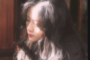 南京雨花城南口腔醫(yī)院高益群整形價(jià)格表附金屬托槽矯正案例展示