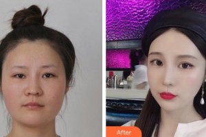 上海新健威醫(yī)療美容門診部宋安堂整形價(jià)格表附頜面整形案例展示