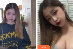 上海明橋醫(yī)療美容門診部金關(guān)鍵整形價(jià)格表附假體隆胸案例展示