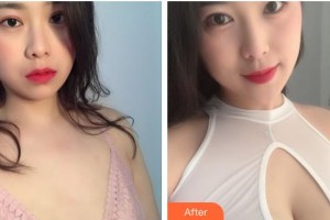 上海奉浦醫(yī)療美容醫(yī)院安群整形價(jià)格表附胸部整形案例展示