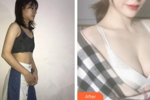 上海博愛(ài)醫(yī)院整形科高健整形價(jià)格表附假體隆胸案例展示