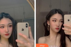 上海市皮膚病醫(yī)院醫(yī)療美容科徐曉云整形價(jià)格表附皮膚管理案例展示