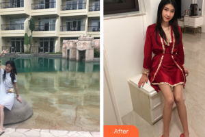 廣州醫(yī)學(xué)院第二附屬醫(yī)院整形美容中心黎志中整形價格表附白瓷娃娃案例展示