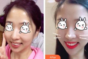 上海瑞東醫(yī)院美容皮膚科劉麗琳整形價格表附無針?biāo)獍咐故?>
</a>
<h3 class=