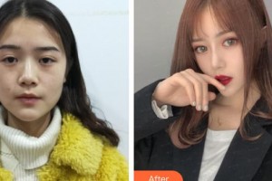 上海港華醫(yī)院浦東分院（悅?cè)葆t(yī)療美容診所）李靜琳整形價格表附美鼻部手術(shù)案例展示