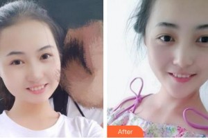 上海保加醫(yī)療美容門診部王麗珊整形價格表附冷光美白案例展示