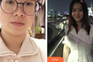 上海薇琳醫(yī)療美容門診部黃敬夏整形價格表附溶脂案例展示