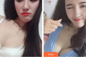 上海明慨醫(yī)療美容門診部張浩杰整形價(jià)格表附濃縮豐胸真實(shí)案例案例展示