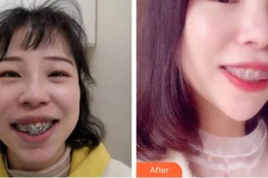 醫(yī)療美容門診部魏東整形價(jià)格表附牙綜合案例展示