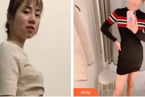 上海萬(wàn)安醫(yī)療美容醫(yī)院馬晶波整形價(jià)格表附光子套餐案例展示