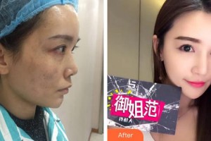 宜昌第二人民醫(yī)院醫(yī)學美容科徐漢珍整形價格表附激光美膚祛斑案例展示