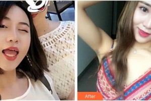 上海雅悅口腔門(mén)診部黃潔整形價(jià)格表附全隱形牙齒矯正案例展示