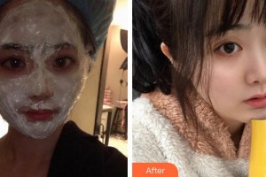 上海迪寇醫(yī)療美容門(mén)診部高中玉整形價(jià)格表附四代熱瑪吉案例展示