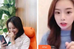 上海維樂(lè)口腔門(mén)診部翟建博整形價(jià)格表附超聲波潔牙案例展示