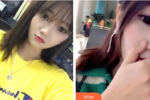 上海拜博昌仁口腔門診部魏兵整形價格表附超聲波潔牙案例展示