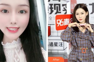 上海雅圣口腔門診部劉玉春整形價格表附隱形矯正案例展示