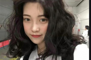 南京愛微醫(yī)療美容門診部姜冬寧整形價格表附玻尿酸精華導(dǎo)入案例展示