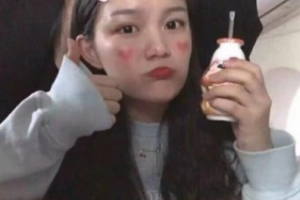 南京愛爾眼科醫(yī)院陳緒攀整形價格表附眼部綜合案例展示