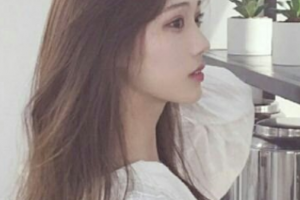 南京醫(yī)科大學(xué)眼科醫(yī)院姜靜整形價格表附切開雙眼皮案例展示