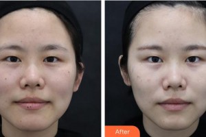 上海鷗美藥妝醫(yī)療美容門診部蕭名杰整形價(jià)格表附激光祛斑案例展示