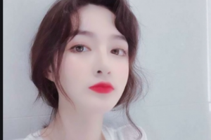 南京寧益眼科中心門診部秦勤整形價格表附切開雙眼皮案例展示