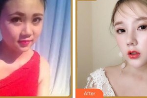 成都市第三人民醫(yī)院醫(yī)學(xué)整形美容科王俸棋整形價(jià)格表附鼻部綜合案例展示