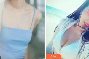 成都漢密爾頓美容醫(yī)院陳佩珍教授整形價(jià)格表附自體脂肪豐胸案例展示