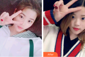 廣州遠(yuǎn)東美容醫(yī)院黃履攸整形價(jià)格表附冷光美白案例展示