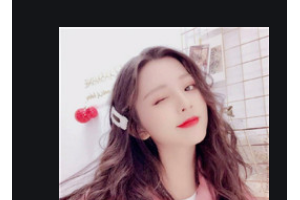 南京卡瓦口腔門診部高德國整形價格表附金屬托槽矯正案例展示