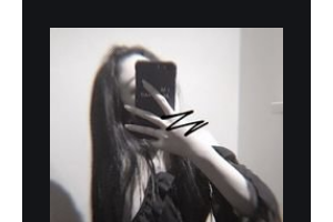 南京雅禾口腔門診部顧森整形價格表附超聲波潔牙案例展示