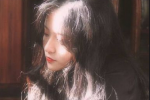 南京雅康口腔門診部王志軍整形價格表附金屬托槽矯正案例展示