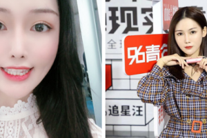 南京博韻口腔門診部丁冬梅整形價(jià)格表附金屬托槽矯正案例展示