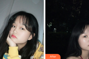 廣州博研醫(yī)療美容門診部劉紅梅整形價格表附光子嫩膚案例展示