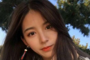 江西武警總隊醫(yī)院整形美容中心余麗整形價格表附膨體墊下巴案例展示