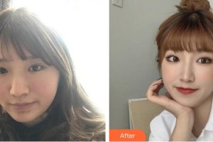 成都艾尚醫(yī)學(xué)美容門診部江海燕整形價格表附超激光美膚美白嫩膚案例展示