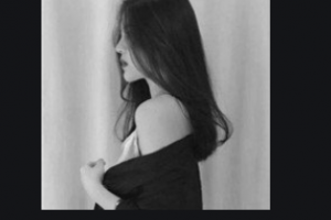 深圳盛美佳門診部美容科田浩整形價格表附下頜角整形案例展示