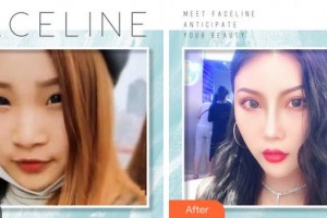 成都金榮醫(yī)學(xué)美容診所張松林整形價格表附吸脂案例展示