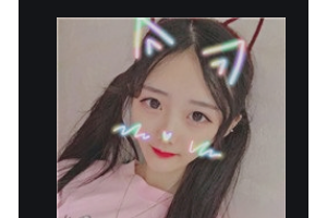 深圳蒳美邇醫(yī)療美容醫(yī)院雷曼蘋整形價格表附光子嫩膚案例展示